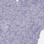 GRIK4 Antibody in Immunohistochemistry (Paraffin) (IHC (P))