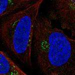 PTCH Antibody in Immunocytochemistry (ICC/IF)