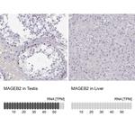 MAGEB2 Antibody in Immunohistochemistry (Paraffin) (IHC (P))