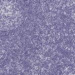 MAGEB2 Antibody in Immunohistochemistry (Paraffin) (IHC (P))