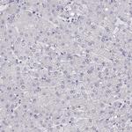 MAGEB2 Antibody in Immunohistochemistry (Paraffin) (IHC (P))