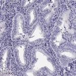 MAGEB2 Antibody in Immunohistochemistry (Paraffin) (IHC (P))