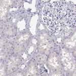 MAGEB2 Antibody in Immunohistochemistry (Paraffin) (IHC (P))