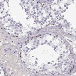 MAGEB2 Antibody in Immunohistochemistry (Paraffin) (IHC (P))