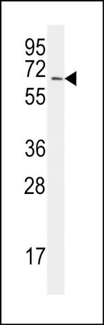 UBA2 Antibody in Western Blot (WB)