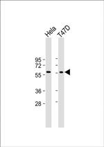 USP21 Antibody in Western Blot (WB)