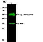 Noggin Antibody in Immunoprecipitation (IP)