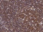 CCR1 Antibody in Immunohistochemistry (Paraffin) (IHC (P))