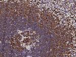 CCR1 Antibody in Immunohistochemistry (Paraffin) (IHC (P))