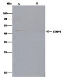 CCR1 Antibody in Immunoprecipitation (IP)