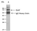 DLAT Antibody in Immunoprecipitation (IP)