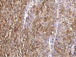 S100A6 Antibody in Immunohistochemistry (Paraffin) (IHC (P))