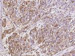 S100A6 Antibody in Immunohistochemistry (Paraffin) (IHC (P))