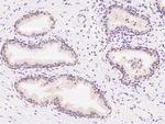 PSPH Antibody in Immunohistochemistry (Paraffin) (IHC (P))