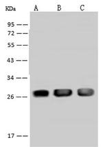 PSPH Antibody in Western Blot (WB)