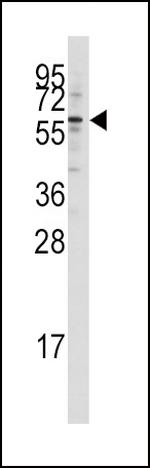 TIP60 Antibody in Western Blot (WB)