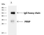 PrP Antibody in Immunoprecipitation (IP)