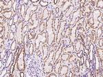 MRPL12 Antibody in Immunohistochemistry (Paraffin) (IHC (P))