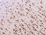 RPS5 Antibody in Immunohistochemistry (Paraffin) (IHC (P))