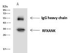 RFXANK Antibody in Immunoprecipitation (IP)