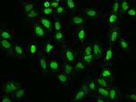 RNMT Antibody in Immunocytochemistry (ICC/IF)