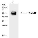 RNMT Antibody in Immunoprecipitation (IP)