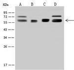 RNMT Antibody in Western Blot (WB)