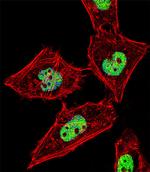 RORA Antibody in Immunocytochemistry (ICC/IF)