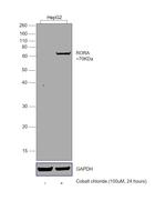 RORA Antibody in Western Blot (WB)