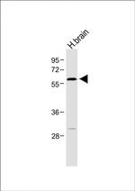 RORA Antibody in Western Blot (WB)