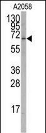 RORA Antibody in Western Blot (WB)