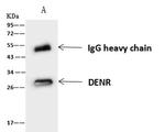 DENR Antibody in Immunoprecipitation (IP)