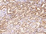 HSDL2 Antibody in Immunohistochemistry (Paraffin) (IHC (P))