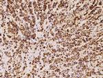 HSDL2 Antibody in Immunohistochemistry (Paraffin) (IHC (P))