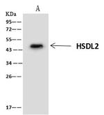 HSDL2 Antibody in Immunoprecipitation (IP)