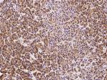 SRP72 Antibody in Immunohistochemistry (Paraffin) (IHC (P))