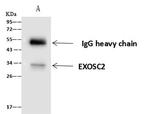 RRP4 Antibody in Immunoprecipitation (IP)