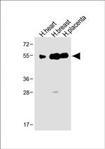 ENT1 Antibody in Western Blot (WB)