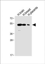 ENT1 Antibody in Western Blot (WB)