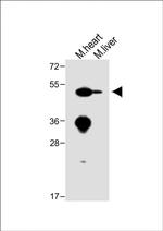 ENT1 Antibody in Western Blot (WB)