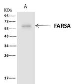 FARSA Antibody in Immunoprecipitation (IP)