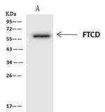 Golgi protein 58k Antibody in Immunoprecipitation (IP)