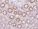 UMPS Antibody in Immunohistochemistry (Paraffin) (IHC (P))