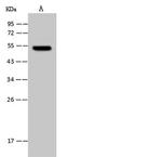 UMPS Antibody in Western Blot (WB)