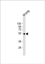 ENT1 Antibody in Western Blot (WB)