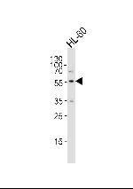 ENT1 Antibody in Western Blot (WB)