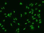 SLCO4C1 Antibody in Immunocytochemistry (ICC/IF)