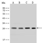 UBE2S Antibody in Western Blot (WB)