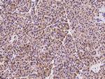 AdoHcyase 2 Antibody in Immunohistochemistry (Paraffin) (IHC (P))