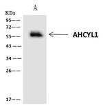 AdoHcyase 2 Antibody in Immunoprecipitation (IP)